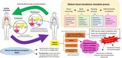 The Use of Fecal Microbiome Transplant in Treating Human Diseases: Too Early for Poop?